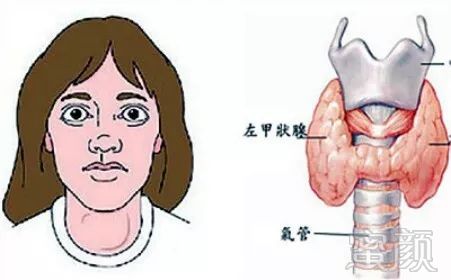 https://img.miyanlife.com/mnt/timg/180402/1115245A7-4.jpg