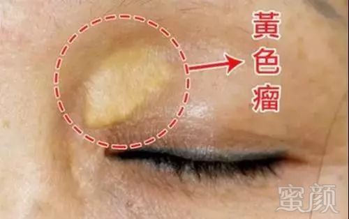 https://img.miyanlife.com/mnt/timg/180402/1115251505-5.jpg