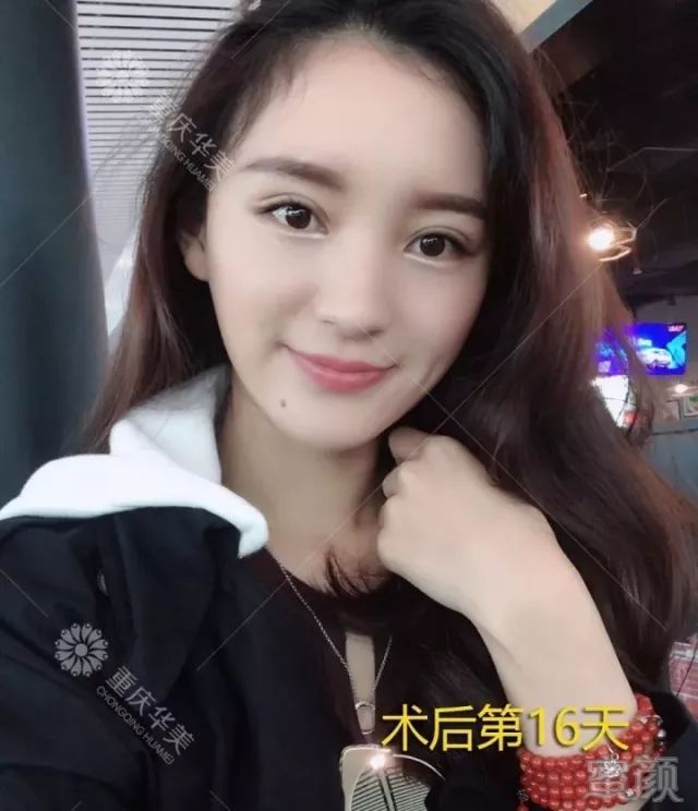 https://img.miyanlife.com/mnt/timg/180402/112035F20-7.jpg