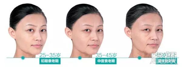 https://img.miyanlife.com/mnt/timg/180402/1120452b4-2.jpg