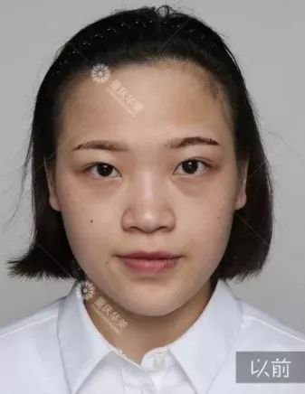 https://img.miyanlife.com/mnt/timg/180402/1120454Y4-11.jpg