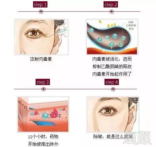 https://img.miyanlife.com/mnt/timg/180402/1120462120-7.jpg