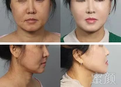 https://img.miyanlife.com/mnt/timg/180402/11204H232-9.jpg
