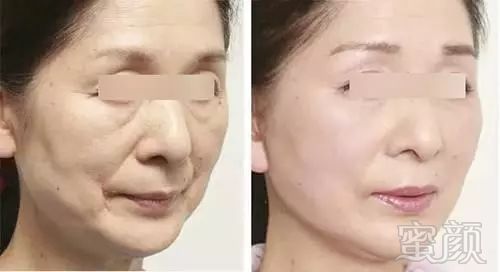 https://img.miyanlife.com/mnt/timg/180402/11204HE6-10.jpg