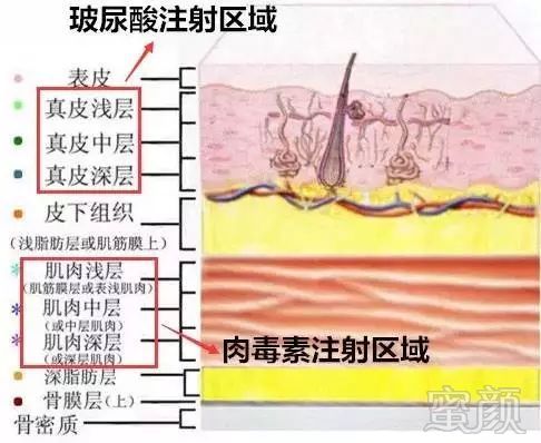 https://img.miyanlife.com/mnt/timg/180402/11204J1U-8.jpg