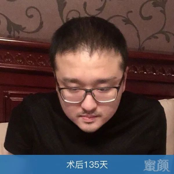 https://img.miyanlife.com/mnt/timg/180402/1121154492-2.jpg
