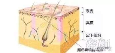 案例图片