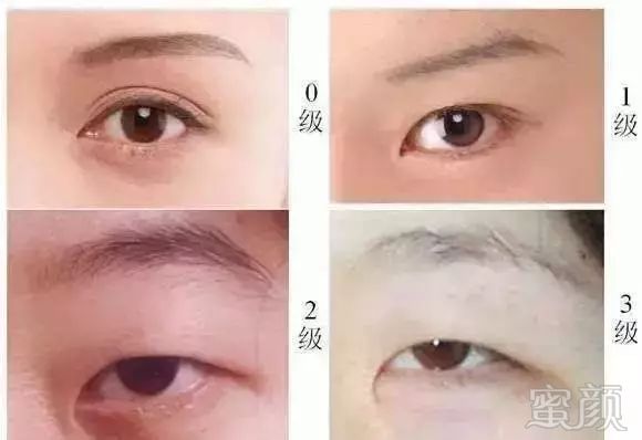 https://img.miyanlife.com/mnt/timg/180402/1131462638-2.jpg