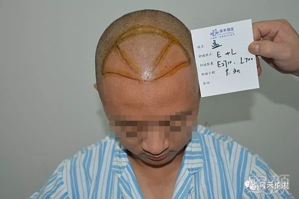 https://img.miyanlife.com/mnt/timg/180402/1132221964-3.jpg