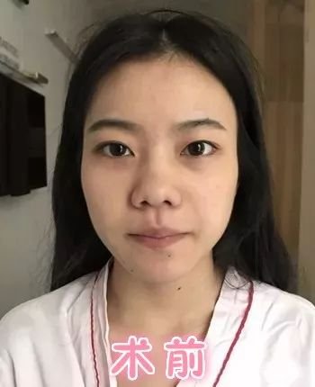 https://img.miyanlife.com/mnt/timg/180402/1133053133-0.jpg