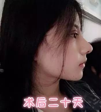 https://img.miyanlife.com/mnt/timg/180402/1133061T1-2.jpg