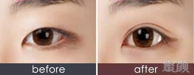 https://img.miyanlife.com/mnt/timg/180402/11422060Y-5.jpg