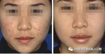 https://img.miyanlife.com/mnt/timg/180403/1039191B7-1.jpg