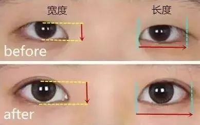 https://img.miyanlife.com/mnt/timg/180403/103Q11T3-15.jpg