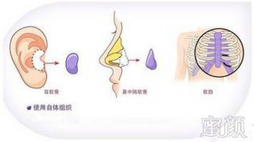 案例图片