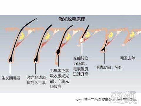 https://img.miyanlife.com/mnt/timg/180403/11555K933-8.jpg