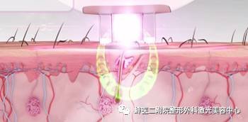 https://img.miyanlife.com/mnt/timg/180403/11555M946-9.jpg