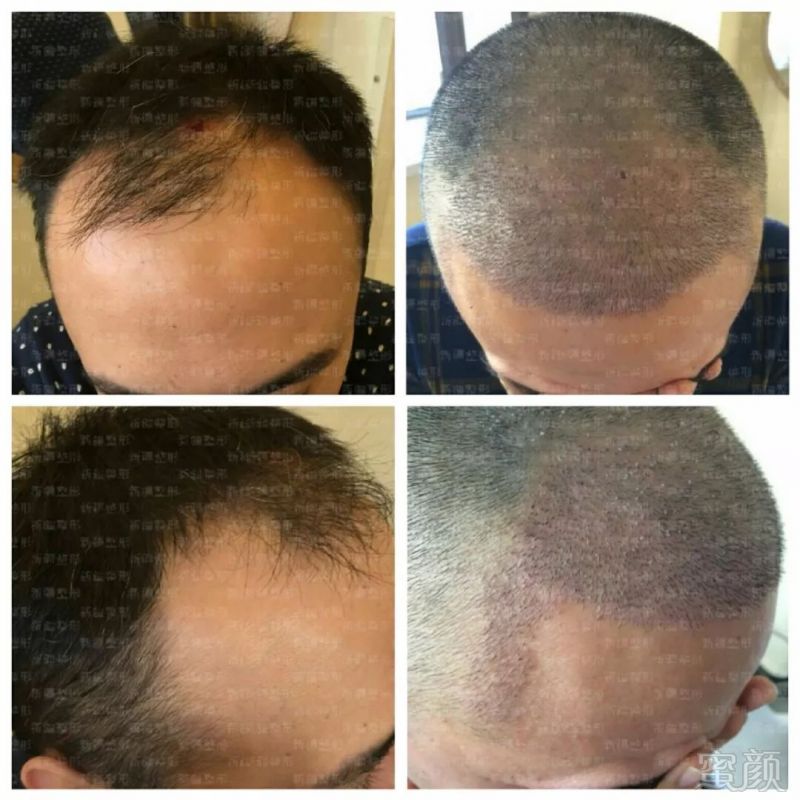 https://img.miyanlife.com/mnt/timg/180403/12004MM6-5.jpg