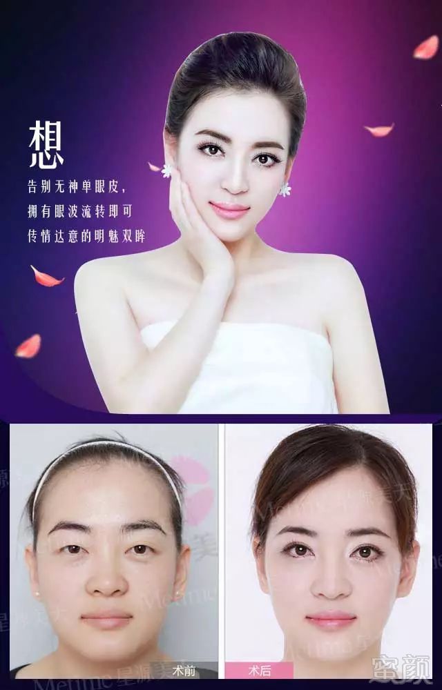 https://img.miyanlife.com/mnt/timg/180403/12392T636-0.jpg