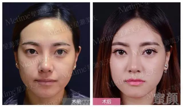 https://img.miyanlife.com/mnt/timg/180403/12393a019-15.jpg
