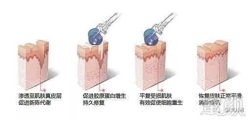 https://img.miyanlife.com/mnt/timg/180404/105501GI-7.jpg