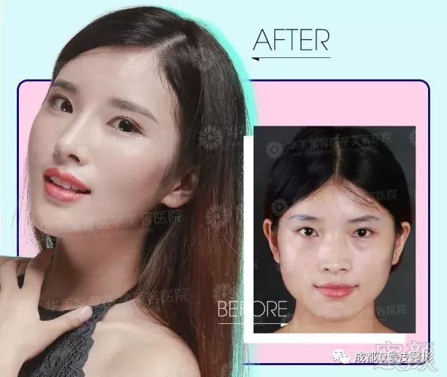 https://img.miyanlife.com/mnt/timg/180404/10564Q3T-4.jpg