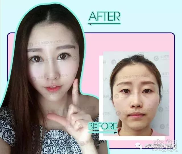 https://img.miyanlife.com/mnt/timg/180404/10564aY4-6.jpg