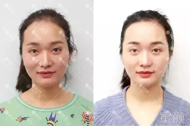 https://img.miyanlife.com/mnt/timg/180404/1120055T7-5.jpg