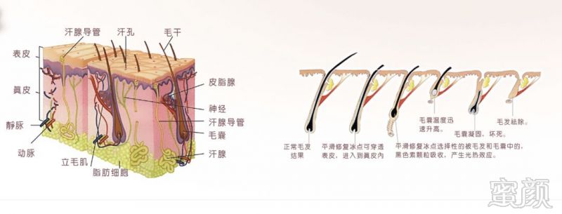 https://img.miyanlife.com/mnt/timg/180404/1139143542-6.jpg