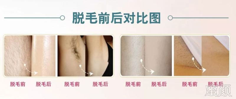 https://img.miyanlife.com/mnt/timg/180404/11391514Q-10.jpg