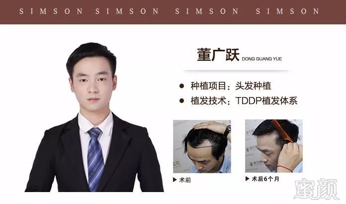 https://img.miyanlife.com/mnt/timg/180404/120330AZ-11.jpg