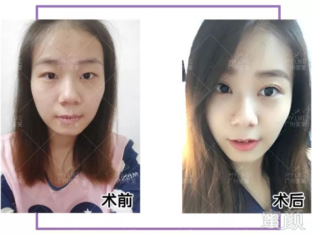 https://img.miyanlife.com/mnt/timg/180404/12061H535-1.jpg