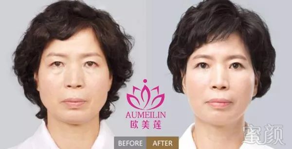 https://img.miyanlife.com/mnt/timg/180404/1210492106-5.jpg