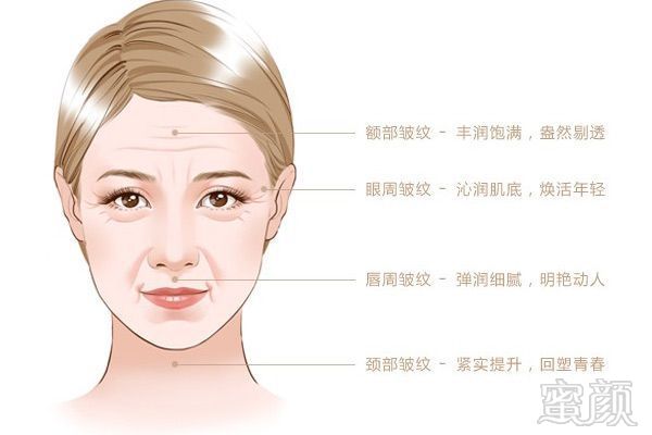 https://img.miyanlife.com/mnt/timg/180405/1249554315-3.jpg