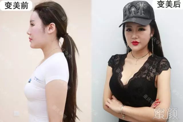 https://img.miyanlife.com/mnt/timg/180405/125639DG-10.jpg