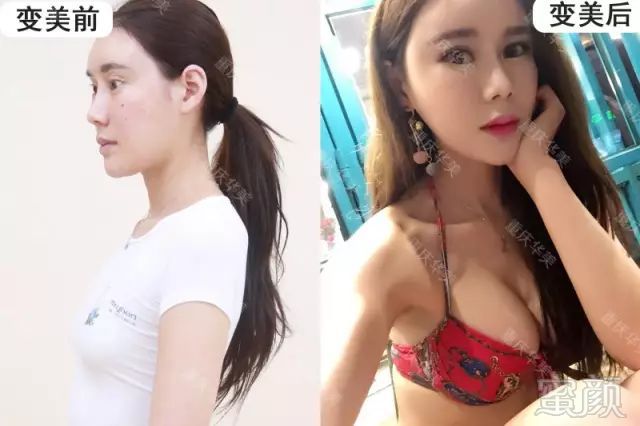 https://img.miyanlife.com/mnt/timg/180405/12563Q131-8.jpg