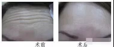https://img.miyanlife.com/mnt/timg/180405/12591M2Y-7.jpg