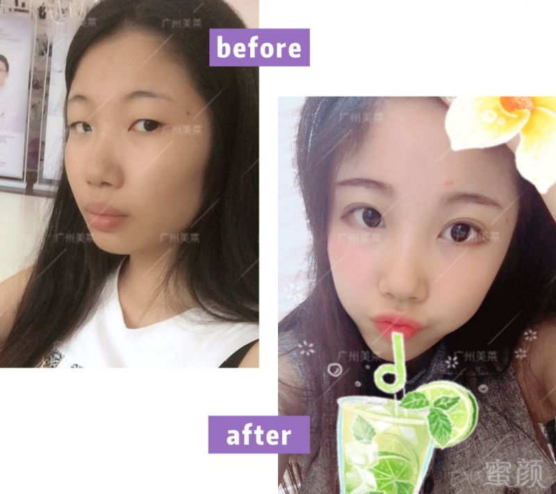 https://img.miyanlife.com/mnt/timg/180405/1304062127-6.jpg