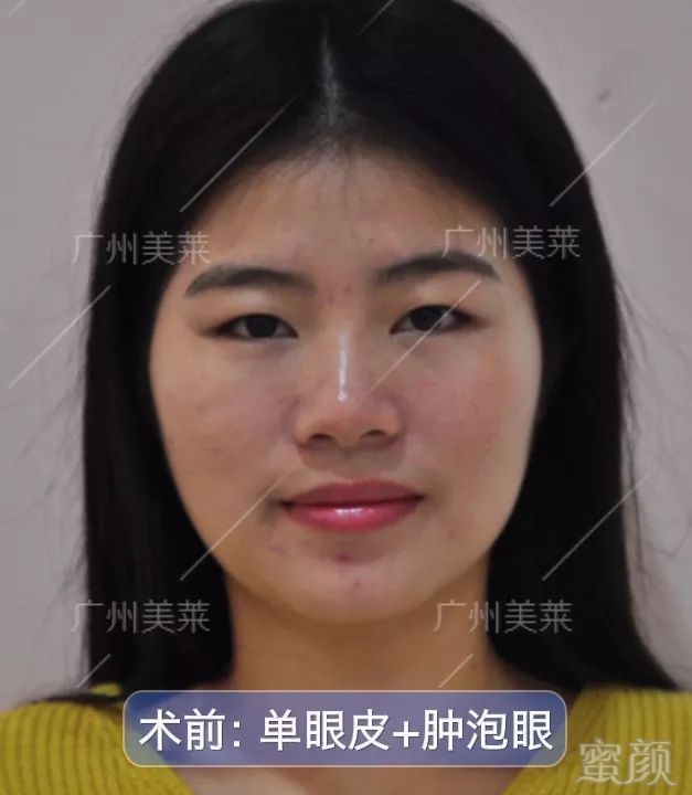 https://img.miyanlife.com/mnt/timg/180405/13040940P-12.jpg