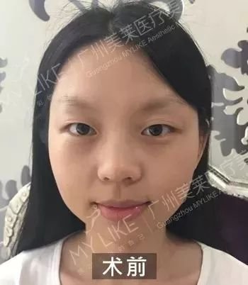 https://img.miyanlife.com/mnt/timg/180405/13040T627-11.jpg