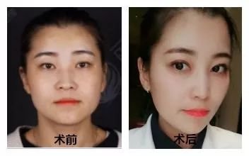 https://img.miyanlife.com/mnt/timg/180405/13245A921-6.jpg
