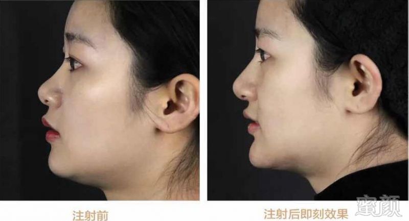 https://img.miyanlife.com/mnt/timg/180405/13245U457-15.jpg
