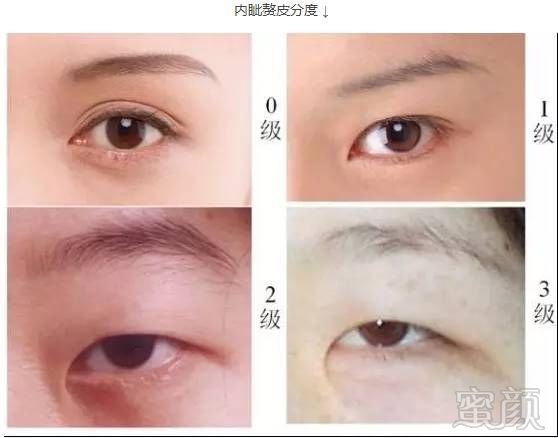 https://img.miyanlife.com/mnt/timg/180405/14412T231-3.jpg