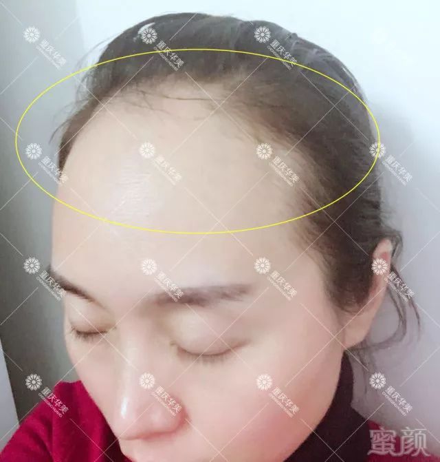 https://img.miyanlife.com/mnt/timg/180406/105FT251-0.jpg