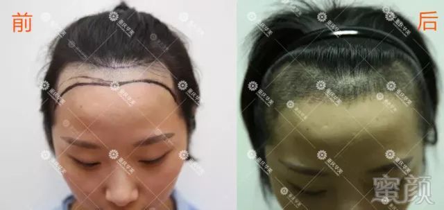 https://img.miyanlife.com/mnt/timg/180406/105G12641-15.jpg