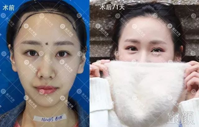 https://img.miyanlife.com/mnt/timg/180406/105G2F55-17.jpg