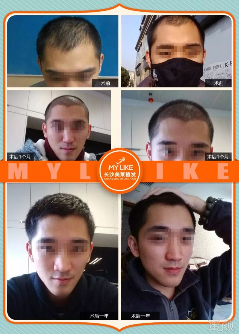 https://img.miyanlife.com/mnt/timg/180406/105I31134-2.jpg