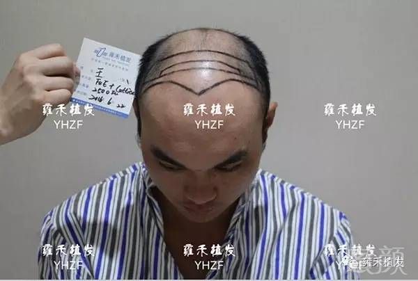 https://img.miyanlife.com/mnt/timg/180406/105RI929-1.jpg