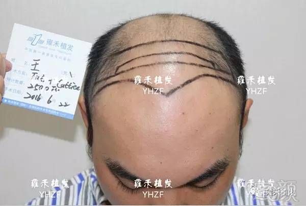 https://img.miyanlife.com/mnt/timg/180406/105RJE6-2.jpg