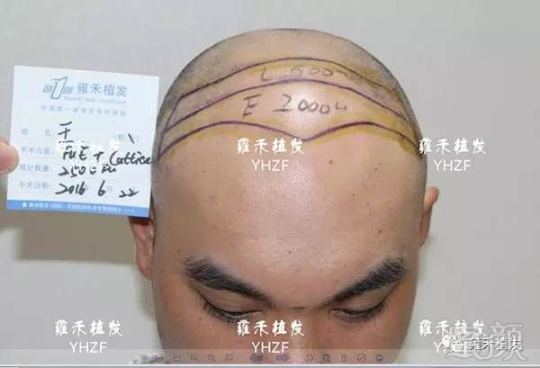 https://img.miyanlife.com/mnt/timg/180406/105RQ2B-4.jpg